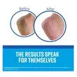thumbnail image of the product